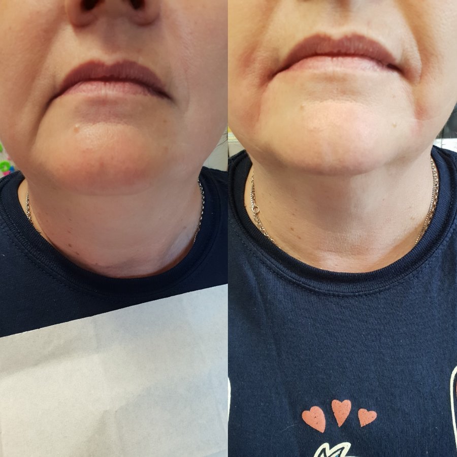 LD جماليات - LD Aesthetics