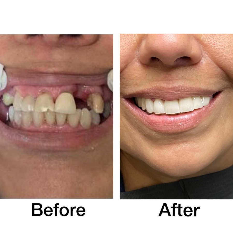 Leon Dental - Leon Dental