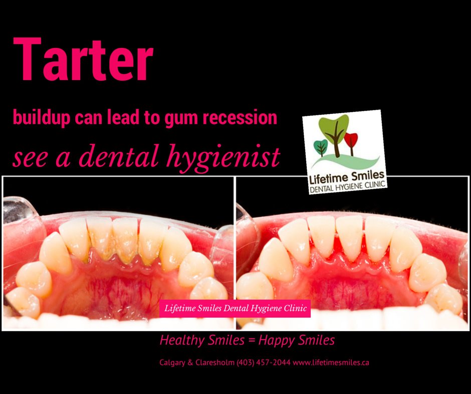 Lifetime Smiles Dental Hygiene Clinic - Lifetime Smiles Dental Hygiene Clinic