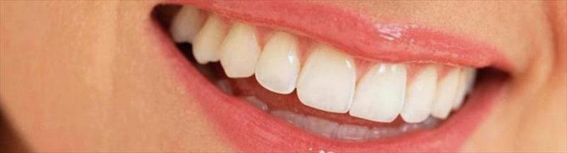 Limassol Dentists - Limassol Dentists