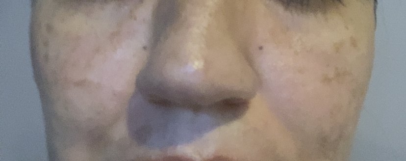 Lincoln Laser Skincare - Lincoln Laser Skincare