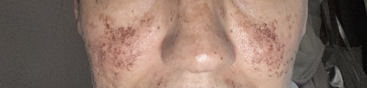 Lincoln Laser Skincare - Lincoln Laser Skincare