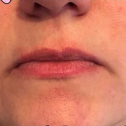 Lisa Moore Therapy - Lisa Moore Therapy