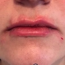 Lisa Moore Therapy - Lisa Moore Therapy