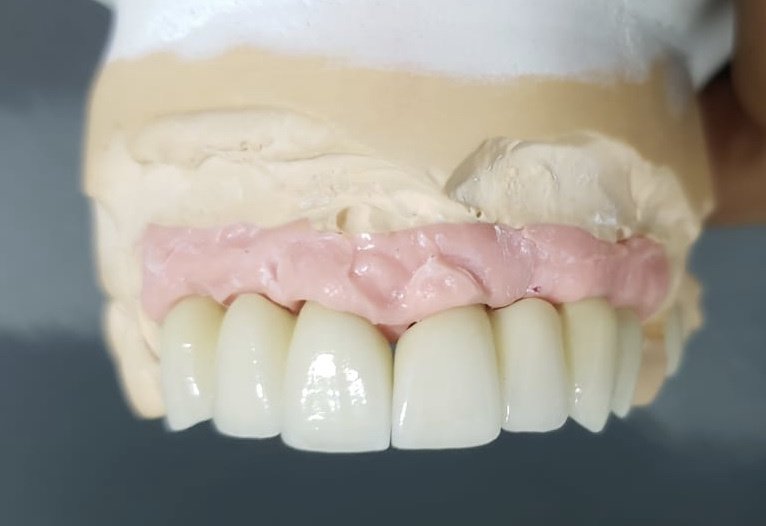 Live Implants Nicaragua - Live Implants Nicaragua