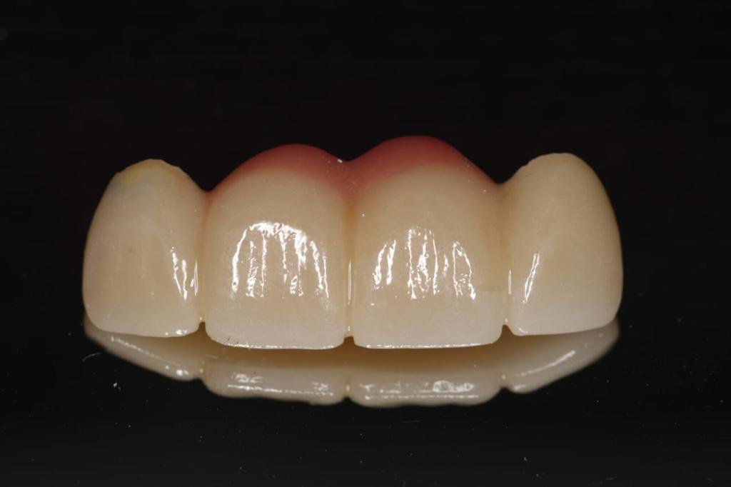 Live Implants Nicaragua - Live Implants Nicaragua