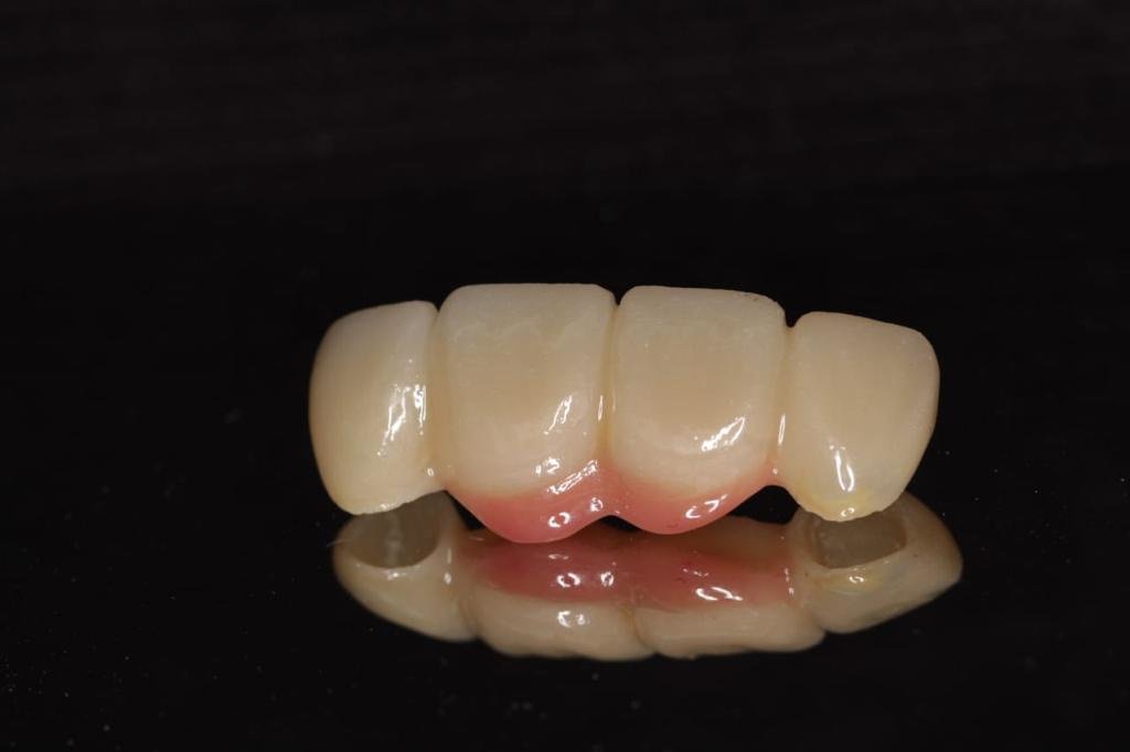 Live Implants Nicaragua - Live Implants Nicaragua