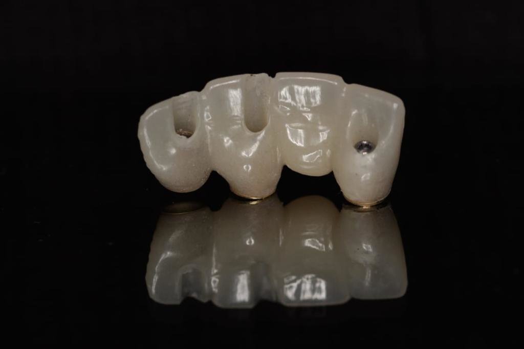 Live Implants Nicaragua - Live Implants Nicaragua