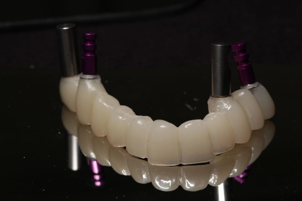 Live Implants Nicaragua - Live Implants Nicaragua