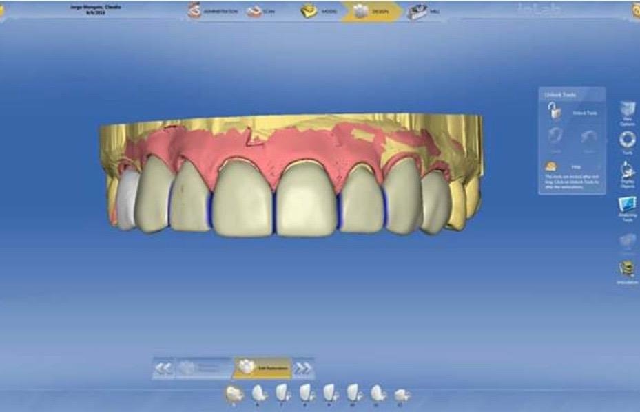 Live Implants Nicaragua - Live Implants Nicaragua