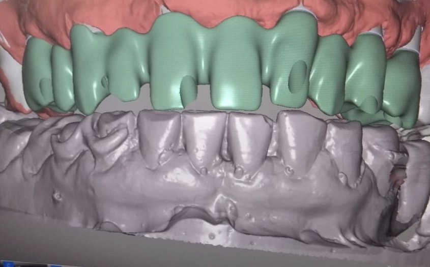 Live Implants Nicaragua - Live Implants Nicaragua