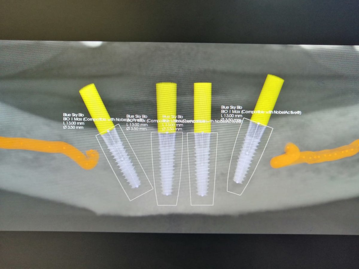 Live Implants Nicaragua - Live Implants Nicaragua