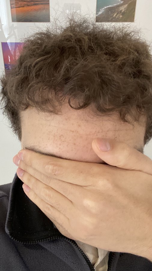 London Hair Transplant Clinic - London Hair Transplant Clinic