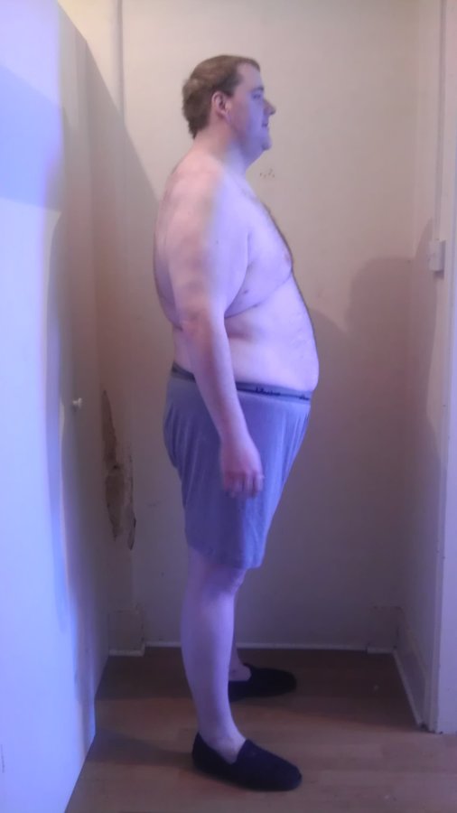 مركز لندن للسمنة - London Obesity Centre
