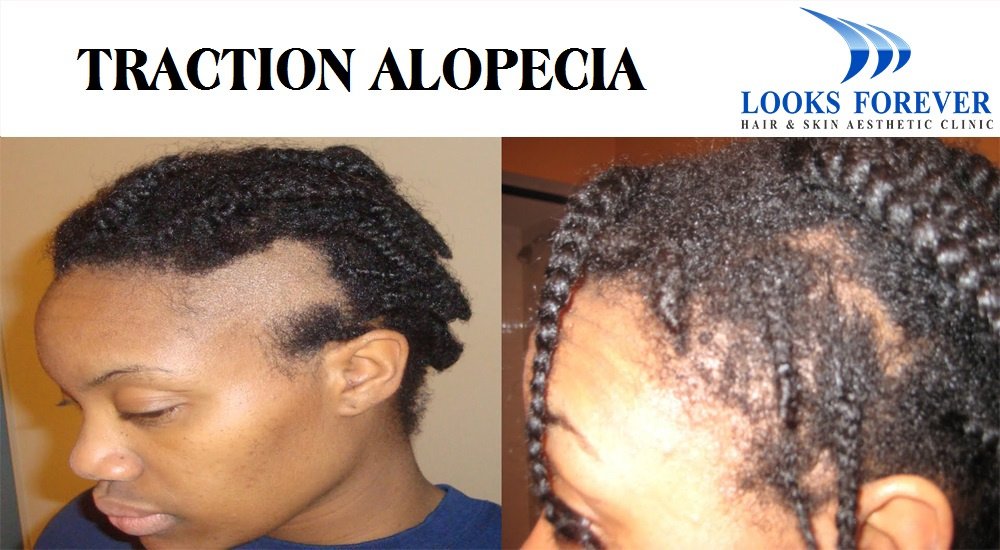 Looks Forever Hair & Skin Aesthetic Clinic - Looks Forever Hair & Skin Aesthetic Clinic