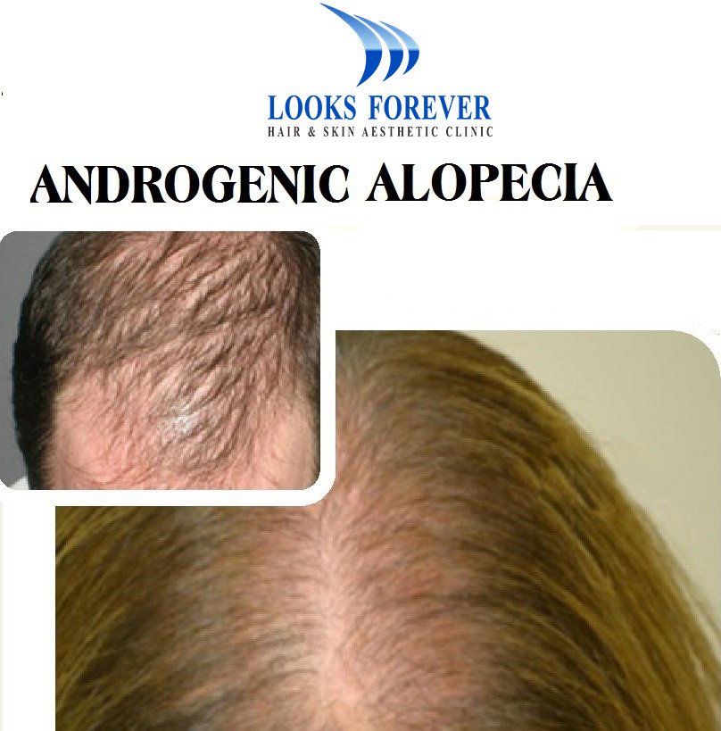 Looks Forever Hair & Skin Aesthetic Clinic - Looks Forever Hair & Skin Aesthetic Clinic