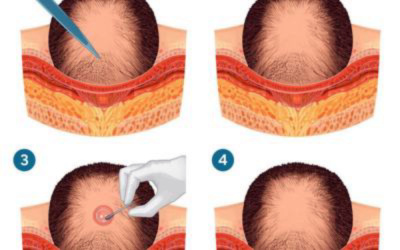 Looks Hair And Skin Clinic - Looks Hair And Skin Clinic