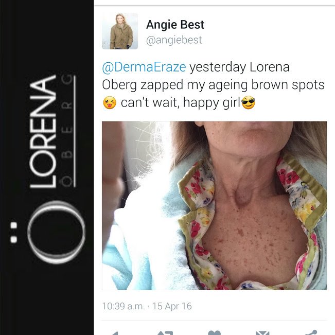 Lorena Oberg - London - Lorena Oberg - London