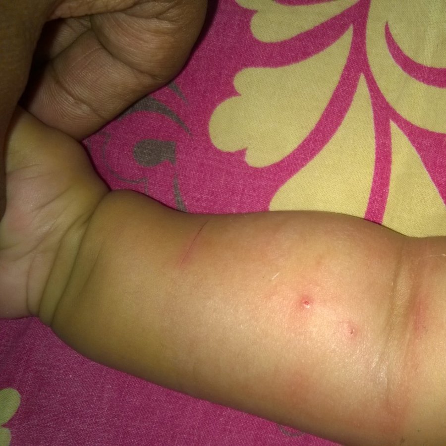 Lotus Children´s Hospital - Kukatpally - Lotus Children´s Hospital - Kukatpally