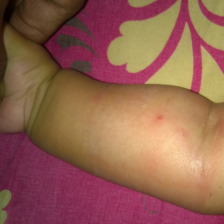 Lotus Children´s Hospital - Kukatpally - Lotus Children´s Hospital - Kukatpally