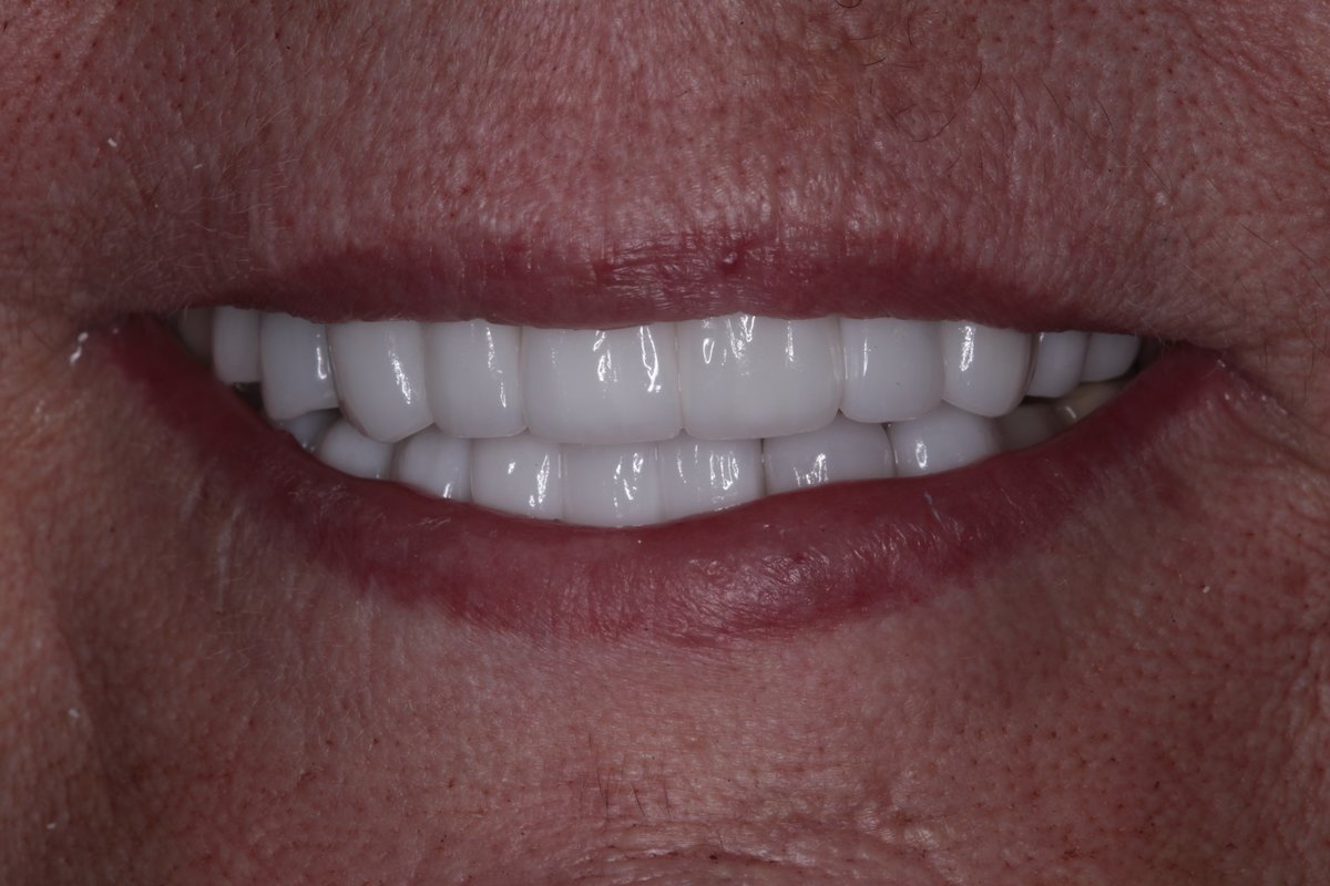 Lovesmile - Dental Implant and Cosmetic Centre - Lovesmile - Dental Implant and Cosmetic Centre