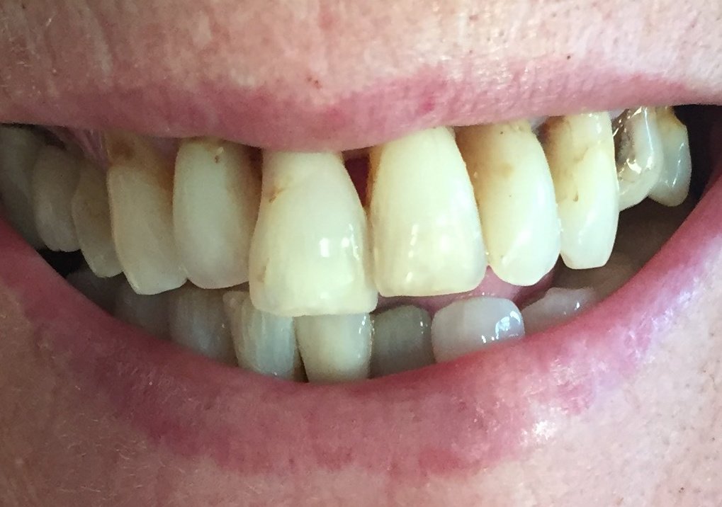 Lovesmile - Dental Implant and Cosmetic Centre - Lovesmile - Dental Implant and Cosmetic Centre