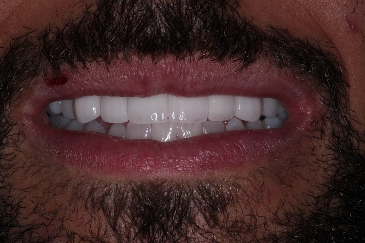 Lovesmile - Dental Implant and Cosmetic Centre - Lovesmile - Dental Implant and Cosmetic Centre