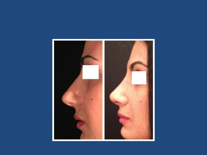 Luigi Maria Lapalorcia, MD - Luigi Maria Lapalorcia, MD