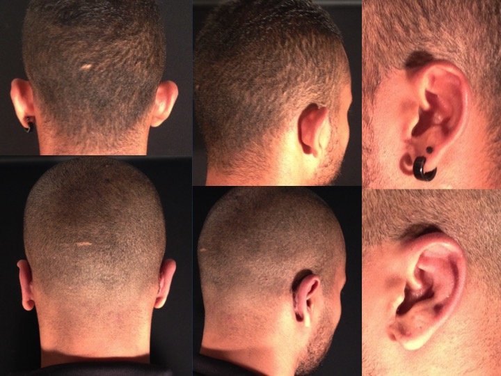 Luigi Maria Lapalorcia, MD - Luigi Maria Lapalorcia, MD