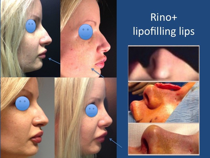 Luigi Maria Lapalorcia, MD - Luigi Maria Lapalorcia, MD