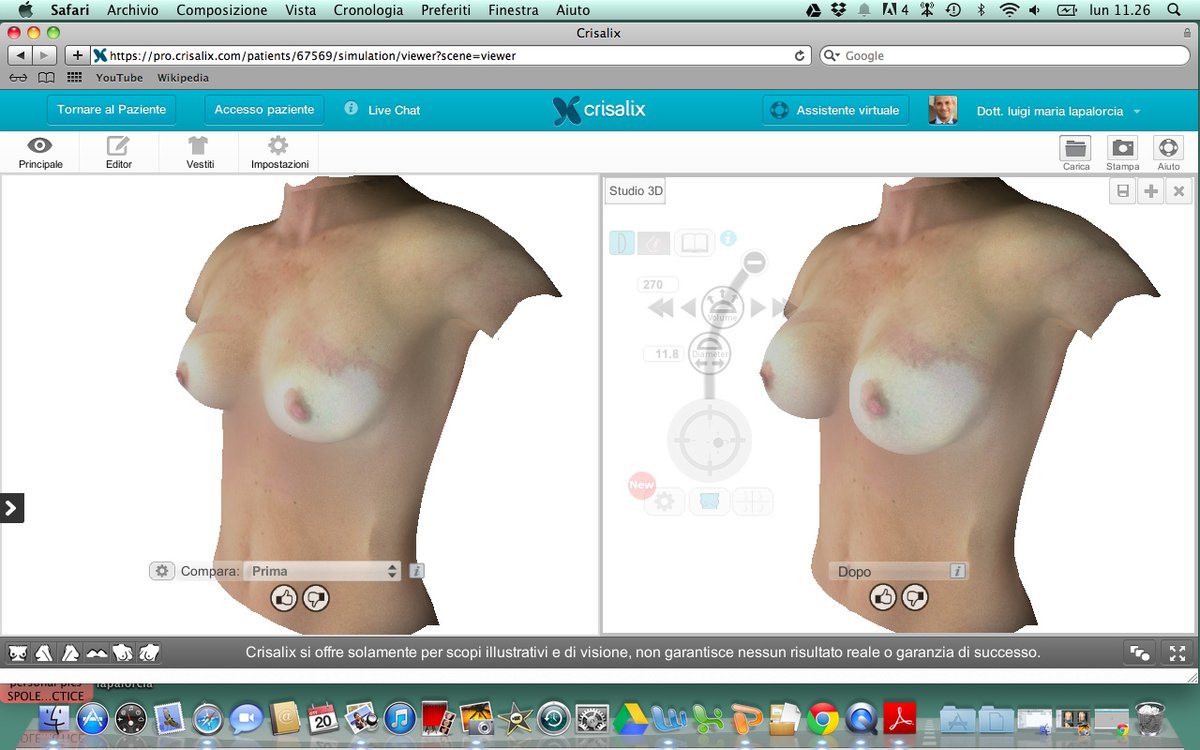 Luigi Maria Lapalorcia, MD - Luigi Maria Lapalorcia, MD