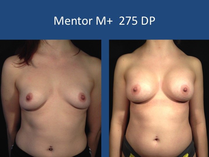 Luigi Maria Lapalorcia, MD - Luigi Maria Lapalorcia, MD