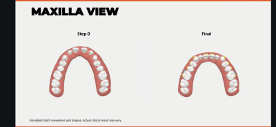 LuxCare Dental - Invisible Braces