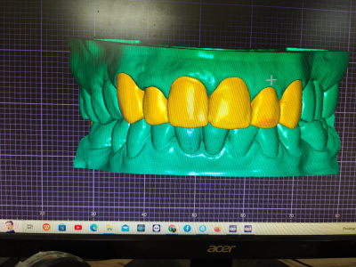 LuxCare Dental - Smile Designing