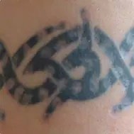 Lynn`s non-laser tattoo removal - Lynn`s non-laser tattoo removal