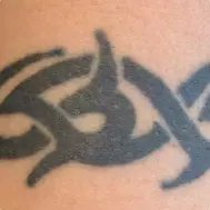 Lynn`s non-laser tattoo removal - Lynn`s non-laser tattoo removal