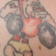 Lynn`s non-laser tattoo removal - Lynn`s non-laser tattoo removal