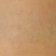 Lynn`s non-laser tattoo removal - Lynn`s non-laser tattoo removal