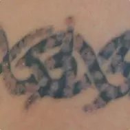 Lynn`s non-laser tattoo removal - Lynn`s non-laser tattoo removal