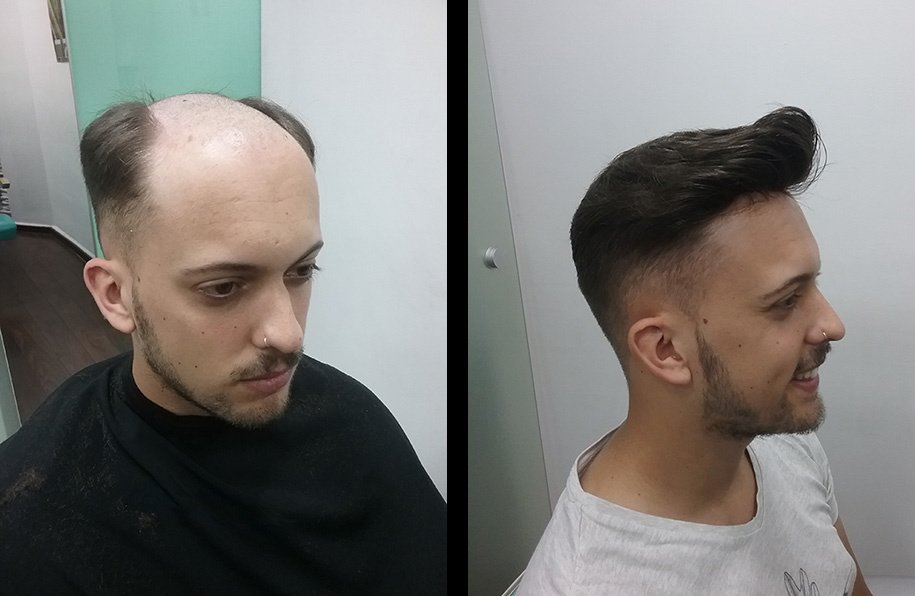 Madeira Hair Clinic - Madeira Hair Clinic