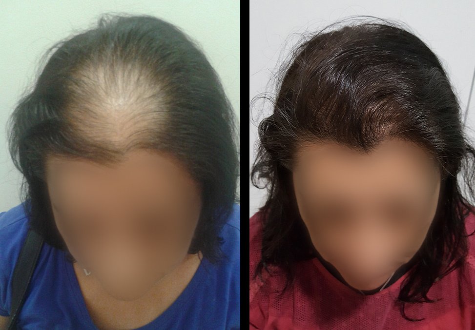 Madeira Hair Clinic - Madeira Hair Clinic