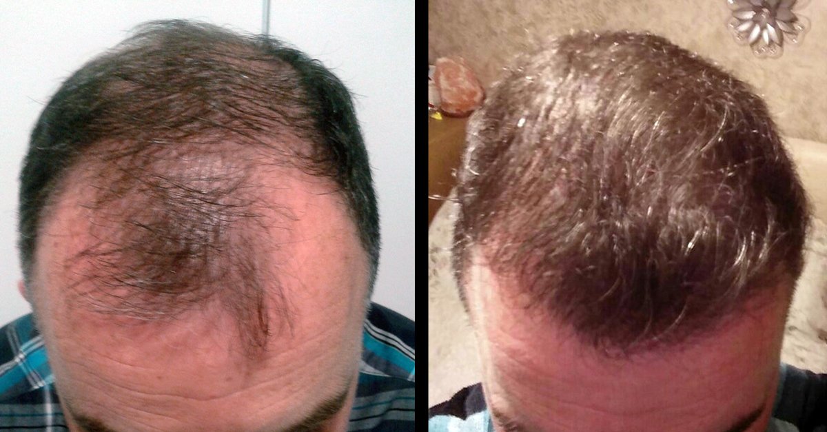 Madeira Hair Clinic - Madeira Hair Clinic