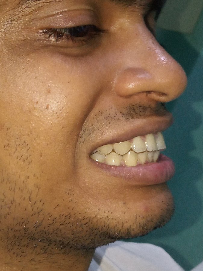 Magadh Oro Dental - Implant & Orthodontic Clinic - Magadh Oro Dental - Implant & Orthodontic Clinic