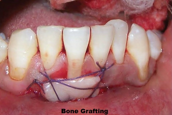 Magadh Oro Dental - Implant & Orthodontic Clinic - Magadh Oro Dental - Implant & Orthodontic Clinic