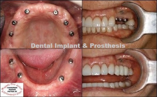 Magadh Oro Dental - Implant & Orthodontic Clinic - Magadh Oro Dental - Implant & Orthodontic Clinic