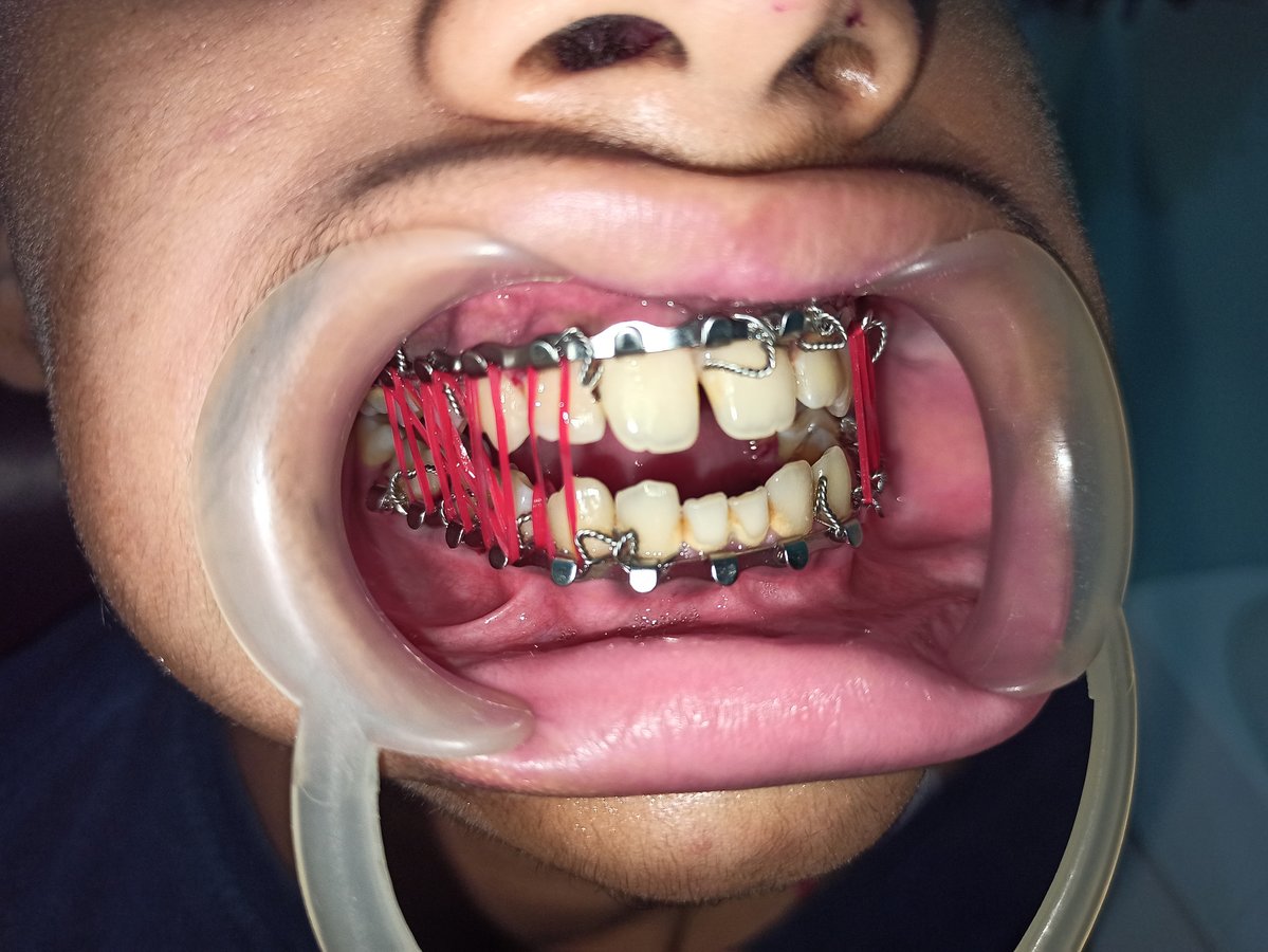 Magadh Oro Dental - Implant & Orthodontic Clinic - Magadh Oro Dental - Implant & Orthodontic Clinic