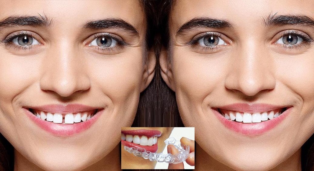 Magadh Oro Dental - Implant & Orthodontic Clinic - Magadh Oro Dental - Implant & Orthodontic Clinic