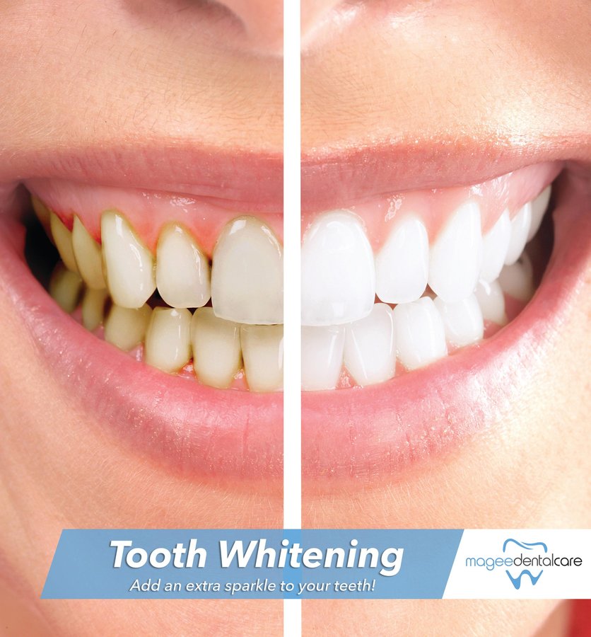 Magee Dental Care - Magee Dental Care