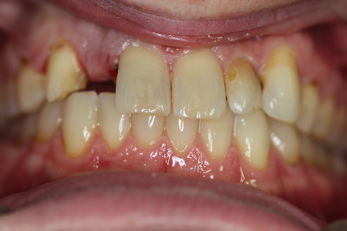 Mahathi Dental Solutions - Mahathi Dental Solutions