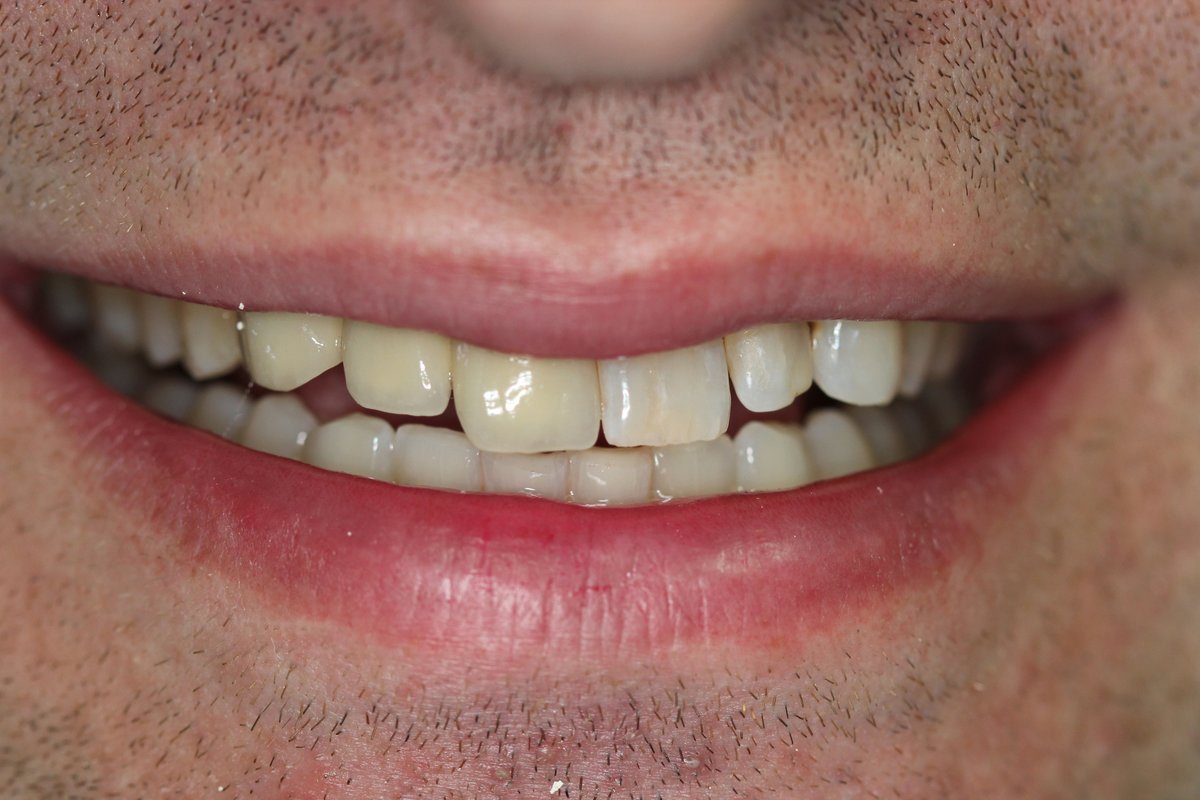 Mahathi Dental Solutions - Mahathi Dental Solutions